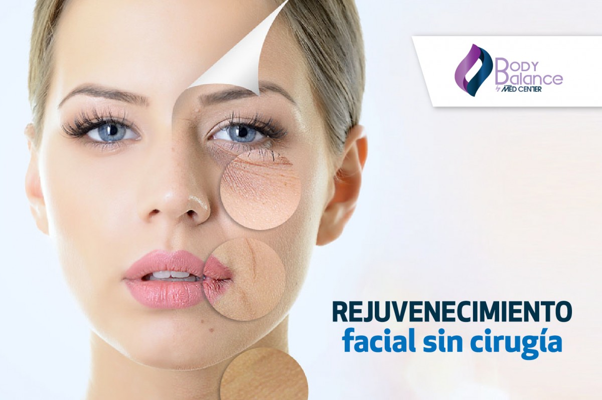 Rejuvenecimiento facial sin cirugía