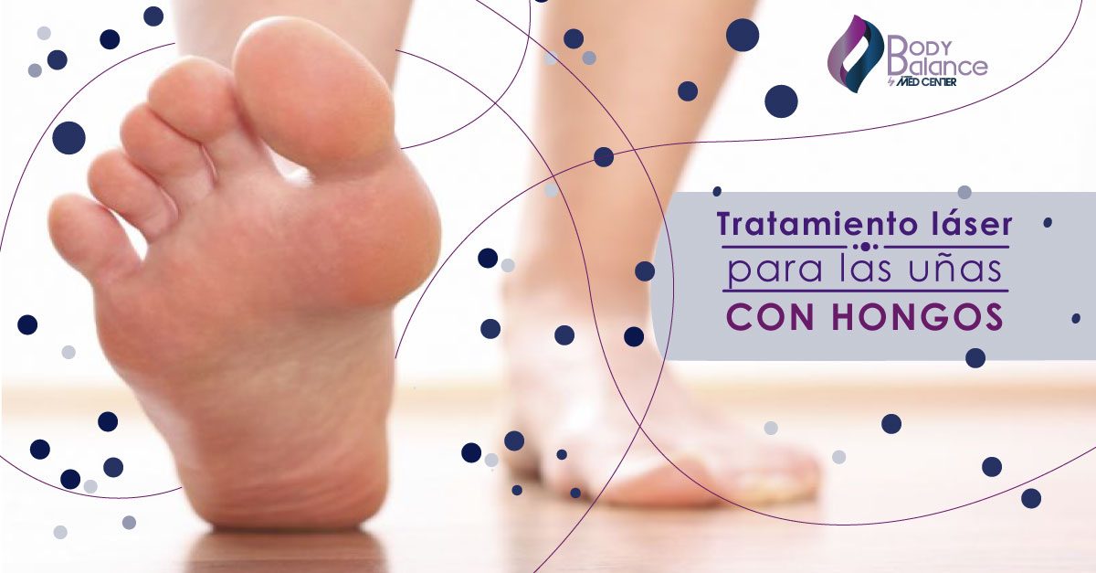 Tratamiento láser para las uñas con hongos